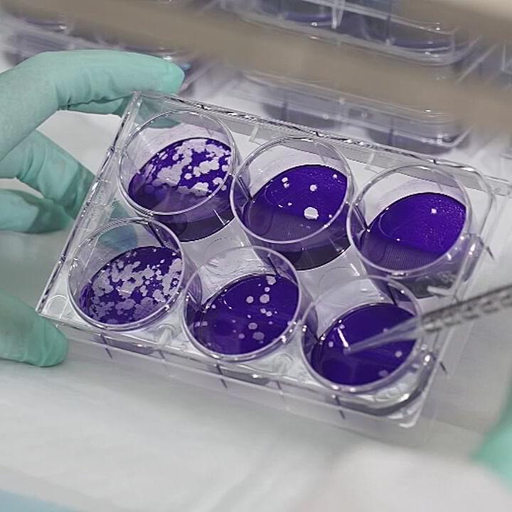 U OF L CO-IMMUNITY RESEARCH - COVID-19 FILE  (3).jpg